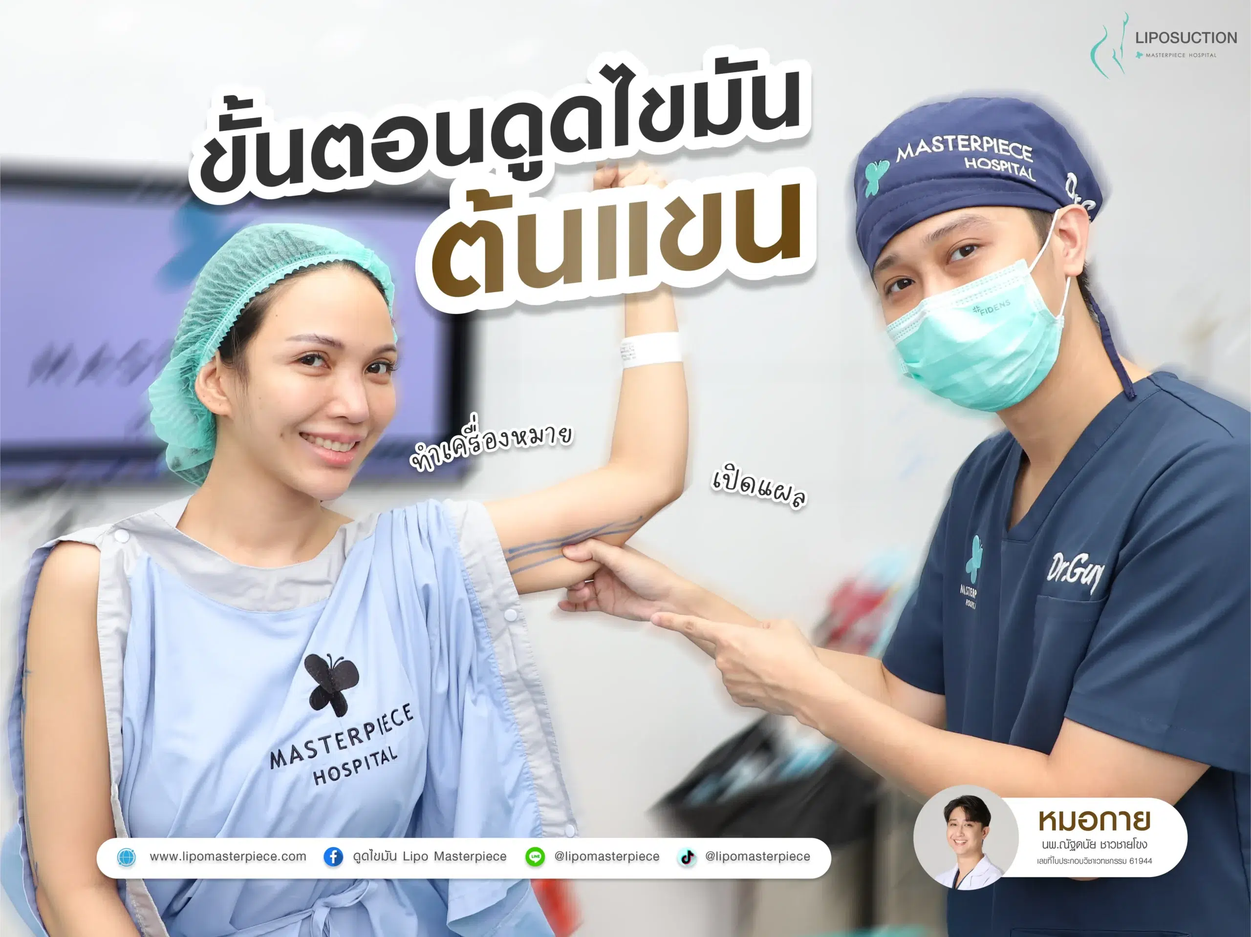 ขั้นตอนการดูดไขมันต้นแขน