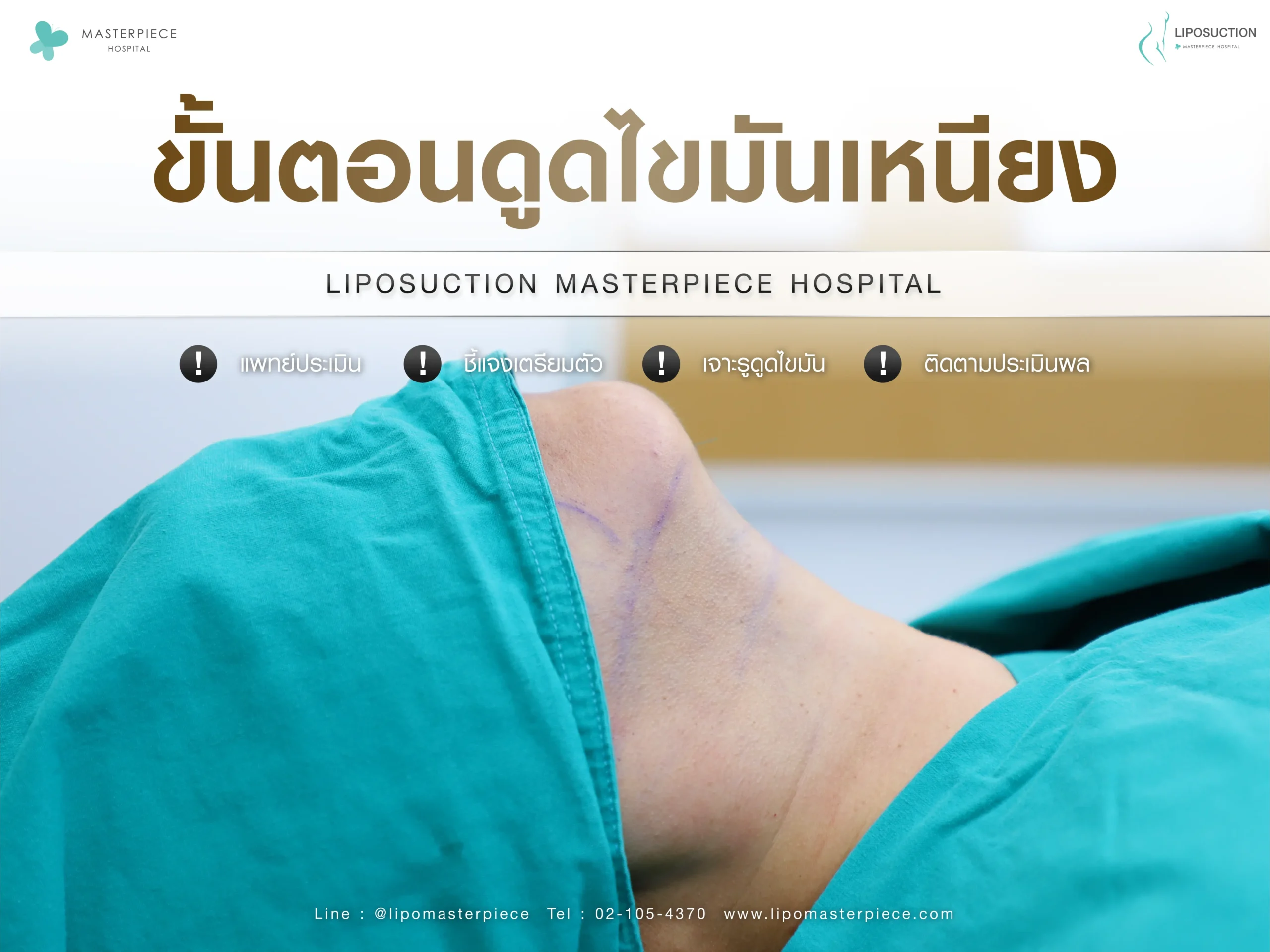 ขั้นตอนการดูดไขมันเหนียง
