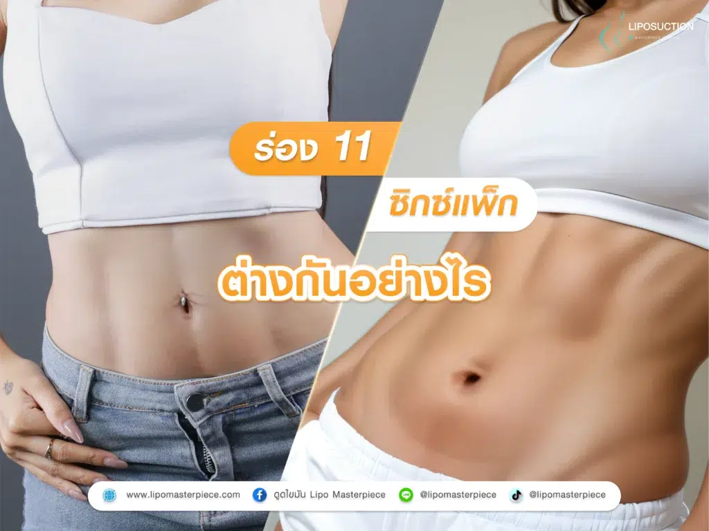 ร่อง 11 กับ ซิกแพคต่างกันอย่างไร