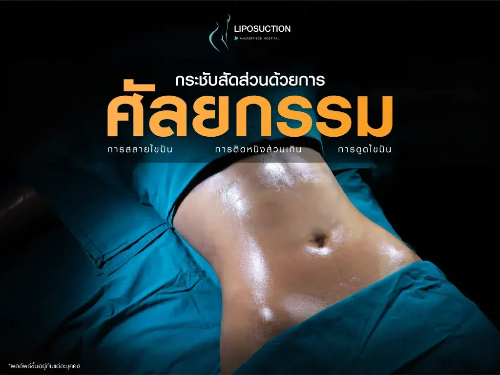 การกระชับสัดส่วนด้วยการทำศัลยกรรม