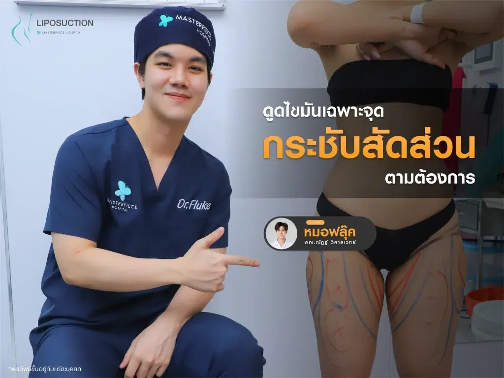 การดูดไขมันเฉพาะจุดกระชับสัดส่วนตามต้องการ