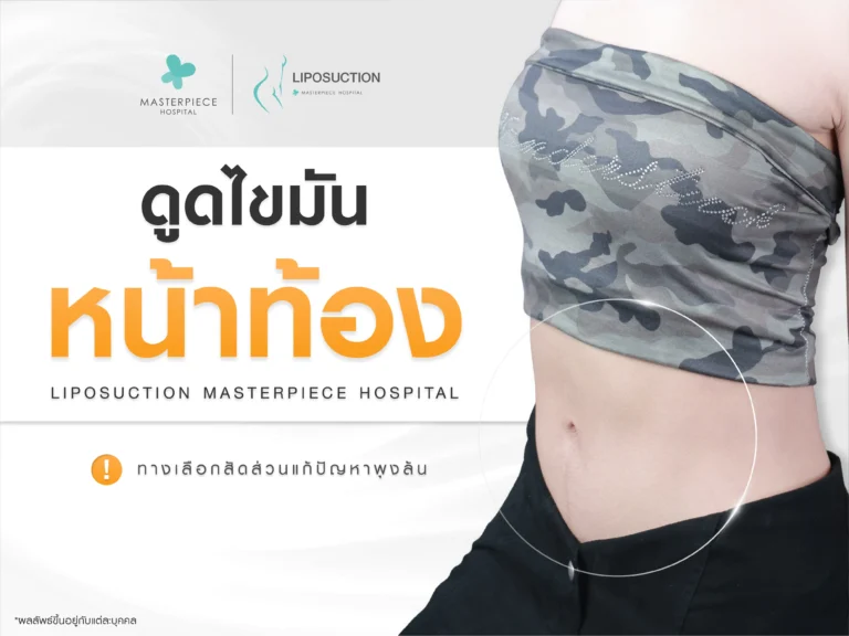 ดูดไขมันหน้าท้อง ทางเลือกลดสัดส่วนแก้ปัญหาพุงล้นแบบไม่ต้องออกกำลังกายหนัก